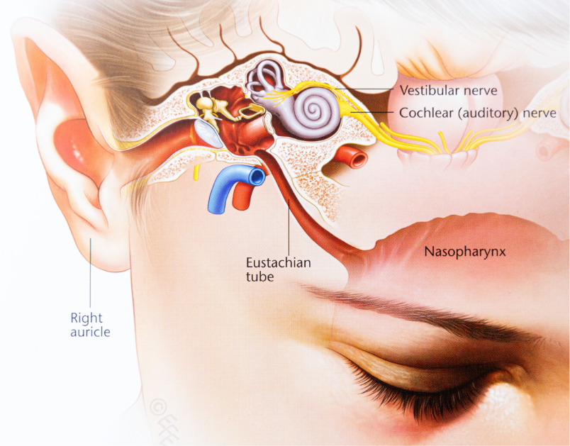 Dr Julia Crawford -Paediatric Glue ear